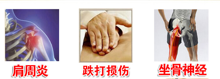 龙布峰针贴多少钱