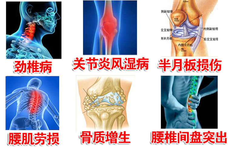 龙布峰针贴正品官网