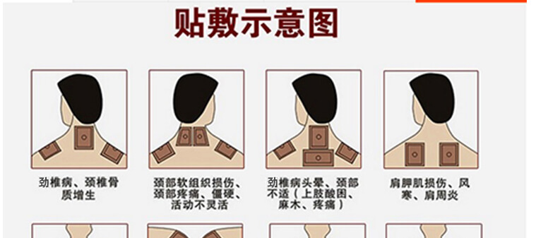 龙布峰针贴价格